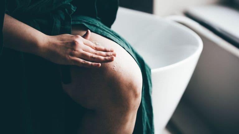 Understanding Cellulite: Causes, Treatments, and Tips for Managing Its Appearance