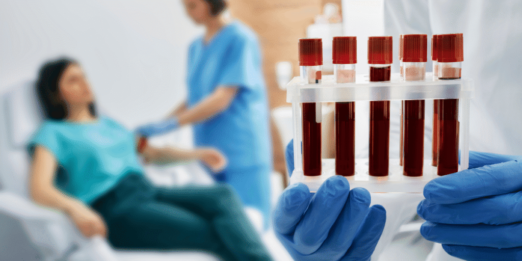 Blood Test for Alzheimer's Disease